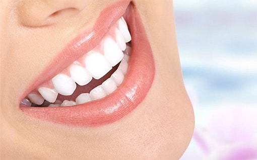 Porcelain veneers in Newmarket