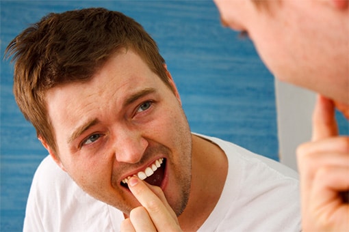 Partially Dislodged Tooth